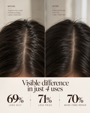 Before and after comparison of a person's dark hair scalp, with text overlays describing scalp improvement and claim percentages at the bottom.